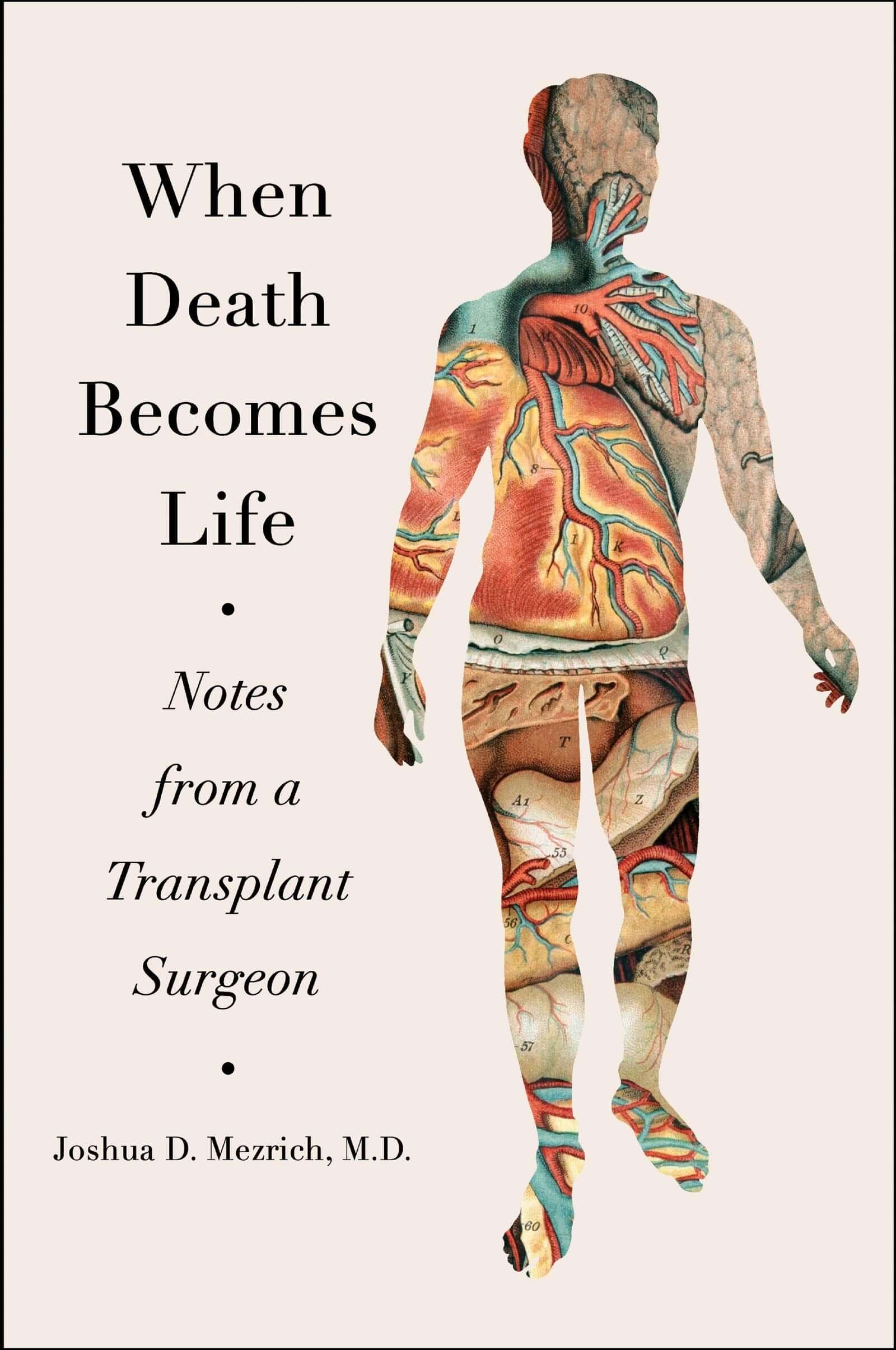 When Death Becomes Life: Notes from a Transplant Surgeon used book depot
