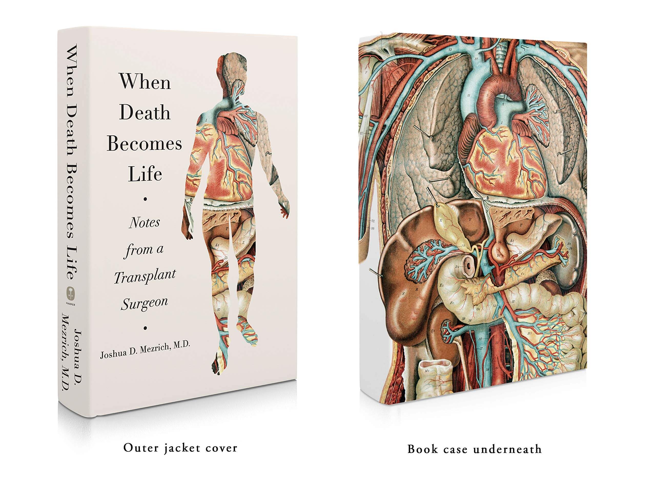 When Death Becomes Life: Notes from a Transplant Surgeon used book depot