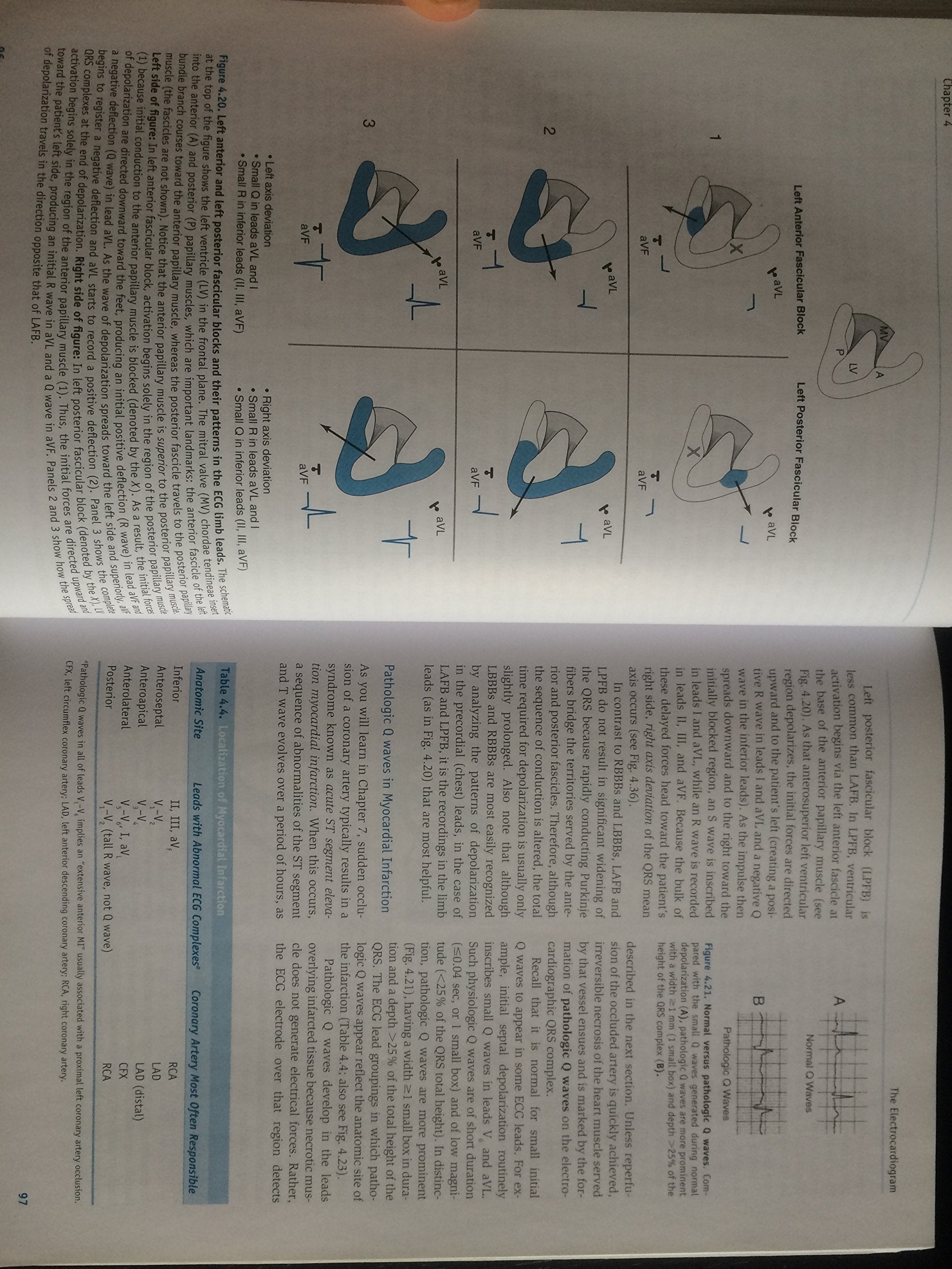 Pathophysiology of Heart Disease: A Collaborative Project of Medical Students and Faculty used book depot