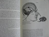 Emotional Intelligence: Why It Can Matter More than IQ