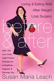 Before and After: Living and Eating Well After Weight Loss Surgery used book depot