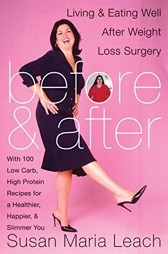 Before and After: Living and Eating Well After Weight Loss Surgery used book depot