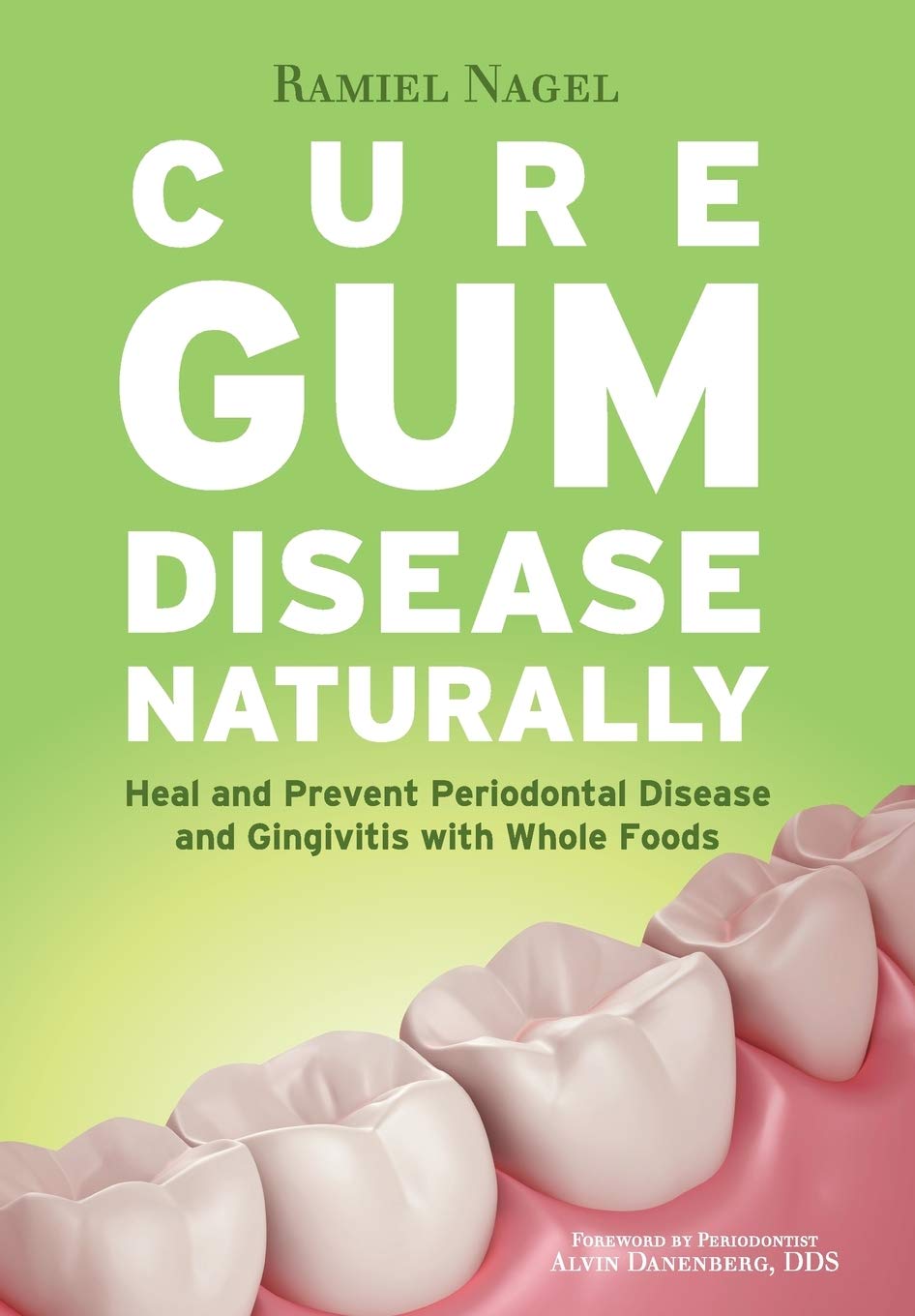 Cure Gum Disease Naturally: Heal and Prevent Periodontal Disease and Gingivitis with Whole Foods used book depot