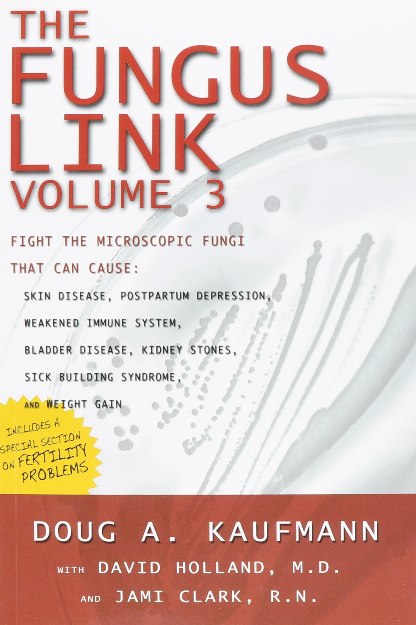 The Fungus Link (Know the Cause!, Volume 3) used book depot